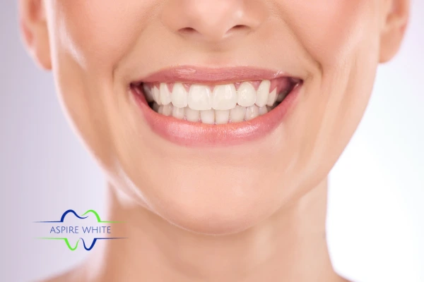 Follow your teeth whitening aftercare Beaconsfield to prolong your whiter smile!