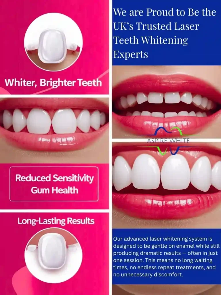 We are Proud to Be the UK’s Trusted Laser Teeth Whitening Experts Beaconsfield